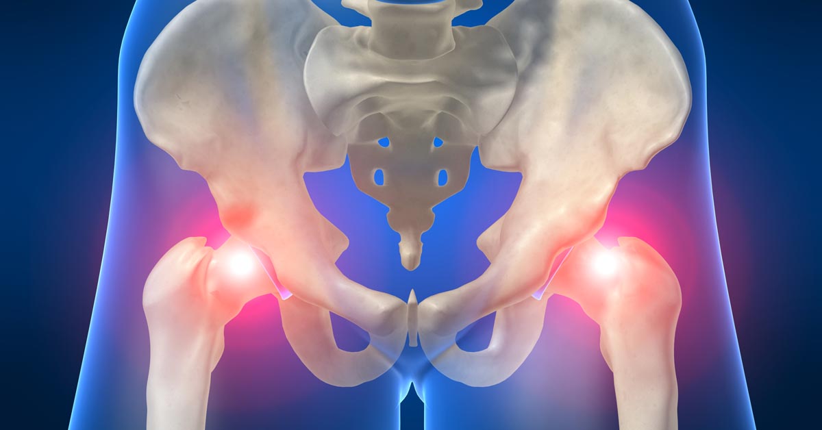Featured image for Chiropractic & Osteopathic Treatment Better for Sciatica Than Surgery
