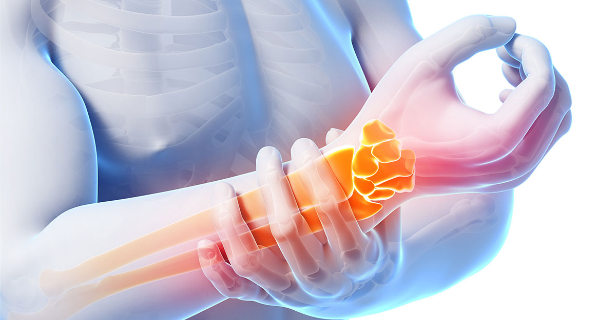 West New York natural carpal tunnel treatment